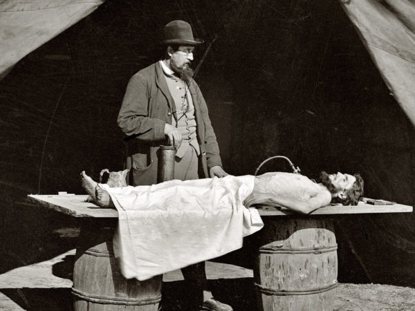 what is embalming?