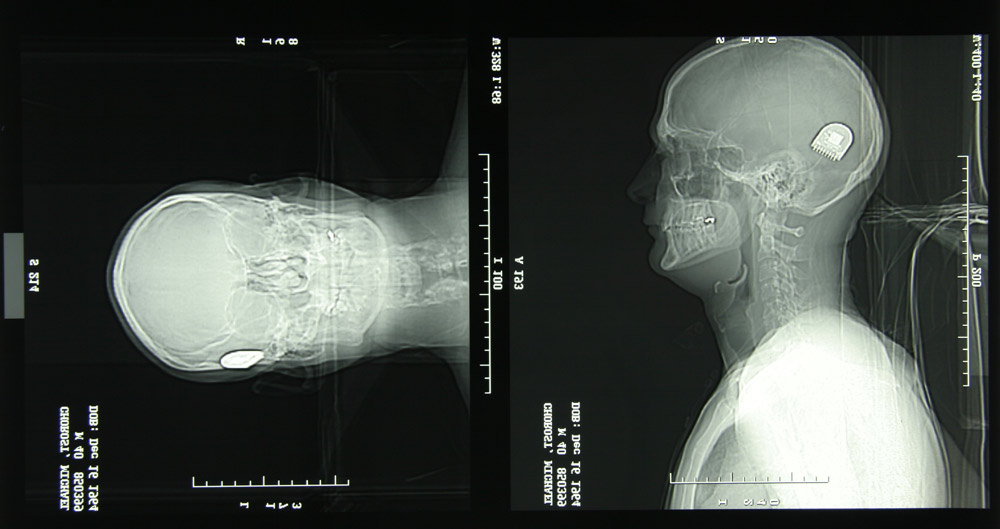 Transhumanism: Can Technology Really Cheat Death?