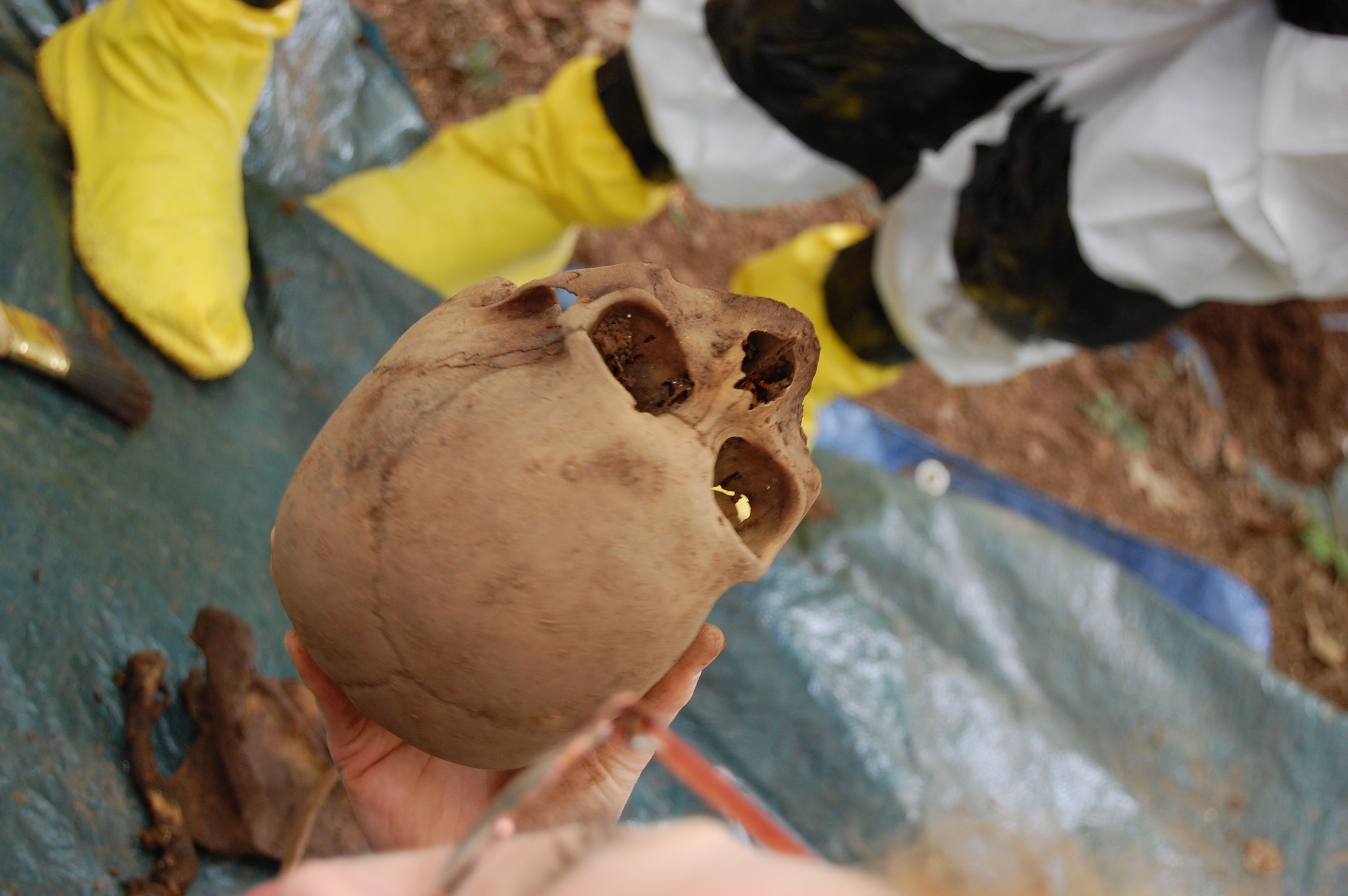 Skull-Excavated-at-Body-Farm